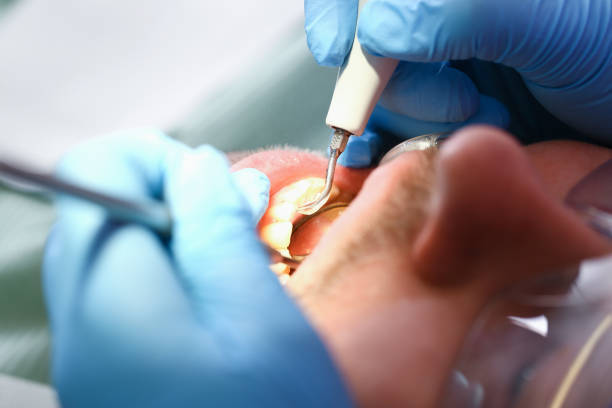 Best Emergency Dentist for Knocked-Out Tooth in Iraan, TX