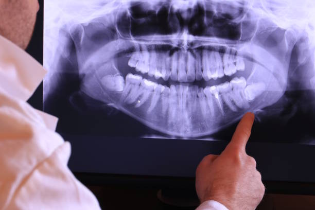 Best Emergency Dental Care for Abscessed Tooth in Iraan, TX